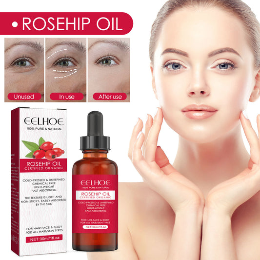 30ml glass bottle of rosehip facial oil with dropper – designed for glow-boosting skincare and cupping rituals.